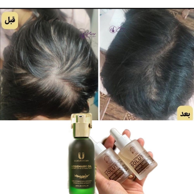 روغن رزماری