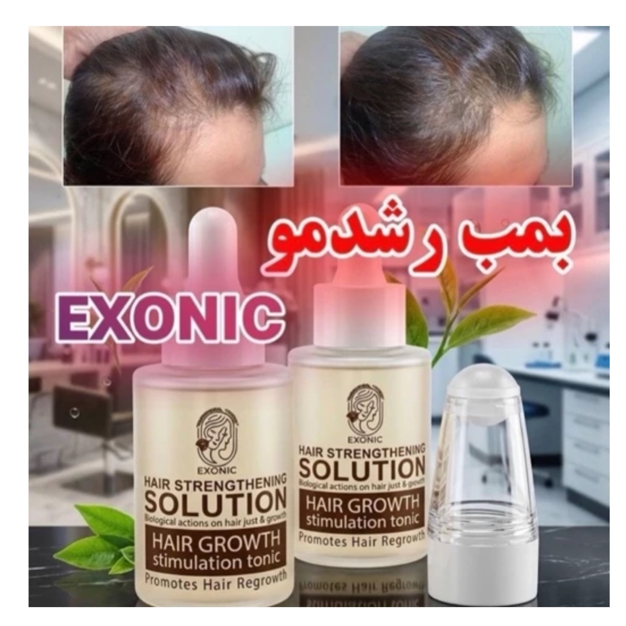 بمب رشد مو