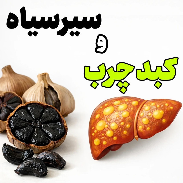 سیر سیاه معجزه گر لاغری شکم و پهلو