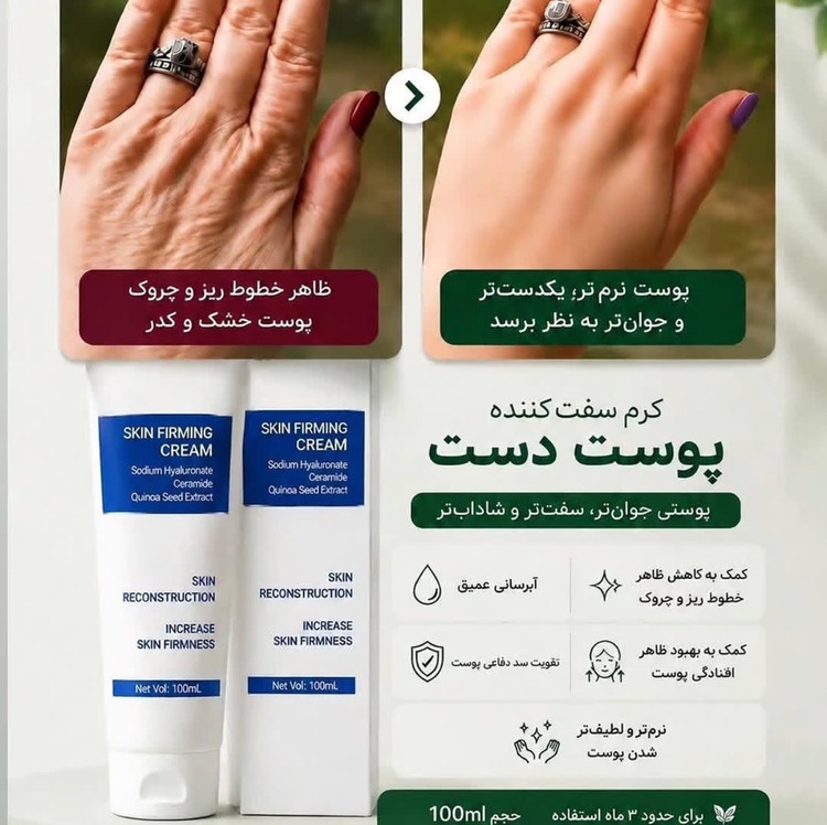 کرم دست